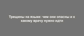 Трещины на языке: чем они опасны и к какому врачу нужно идти